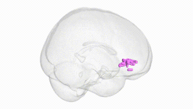 Full Brain White