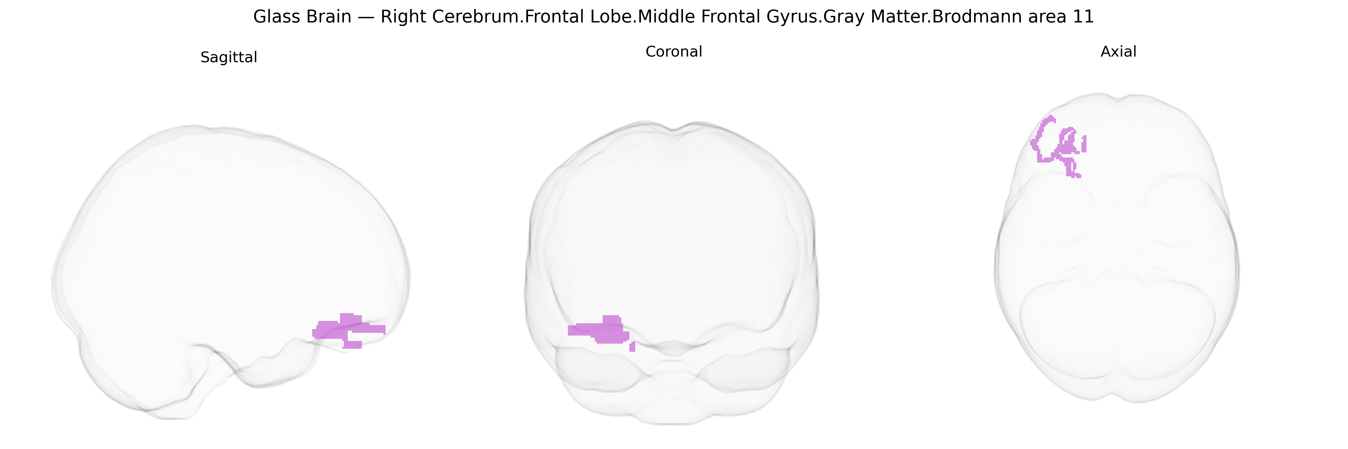 Triplanar Ghost Brain
