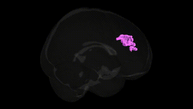 Full Brain Black