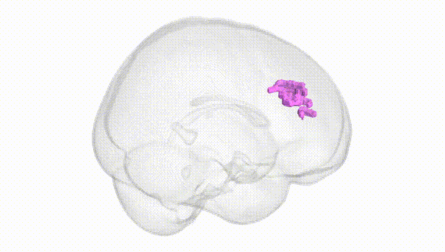 Full Brain White