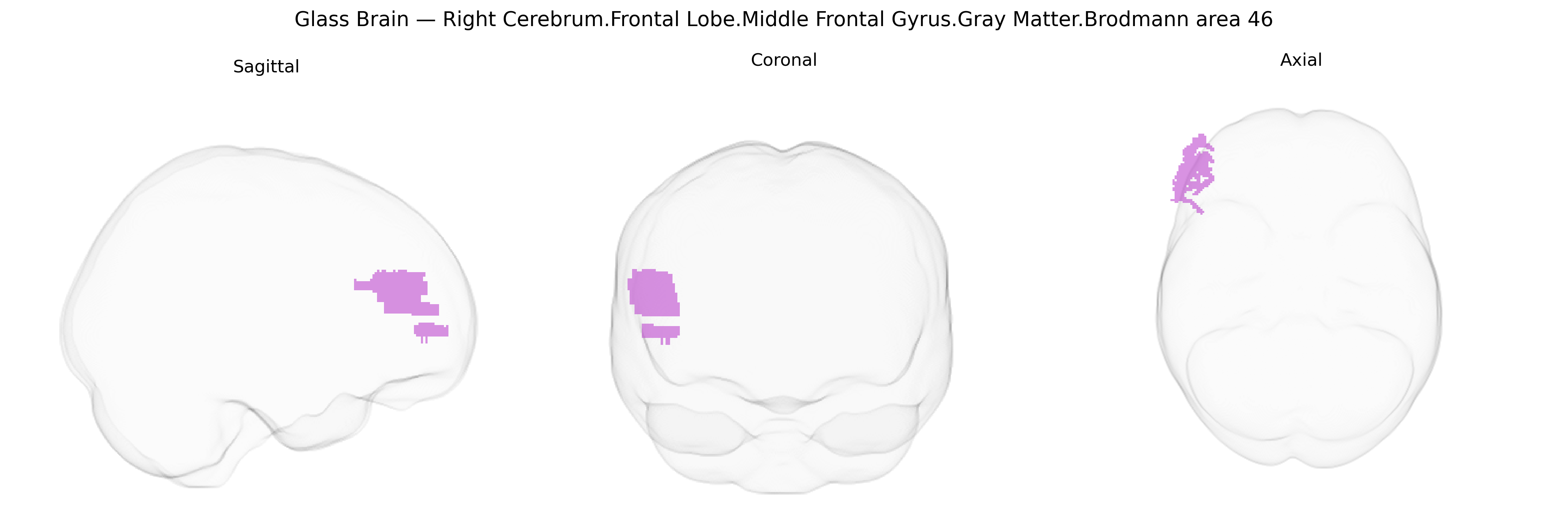 Triplanar Ghost Brain