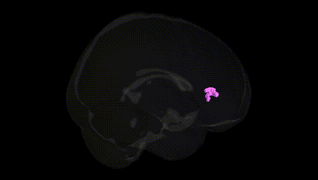 Full Brain Black