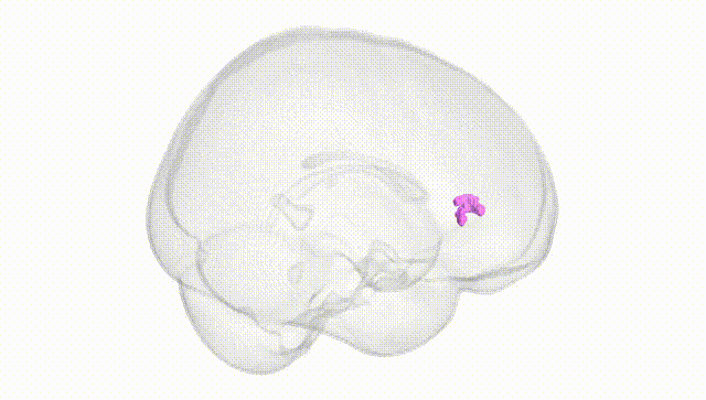Full Brain White