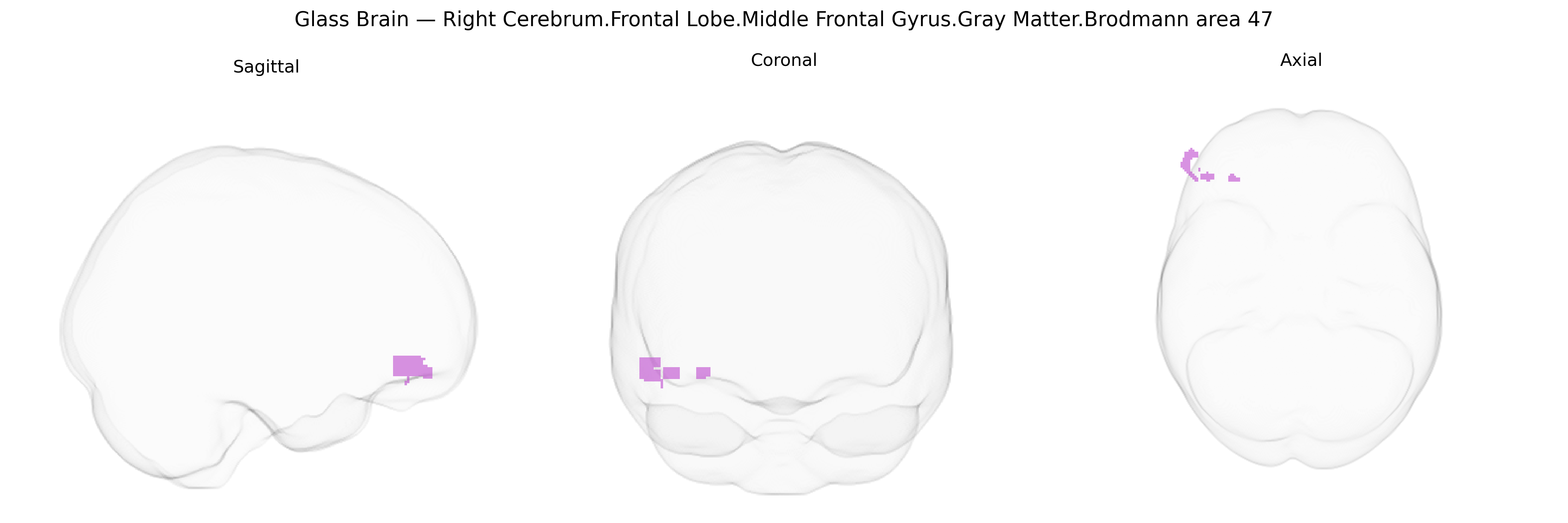 Triplanar Ghost Brain