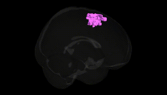 Full Brain Black