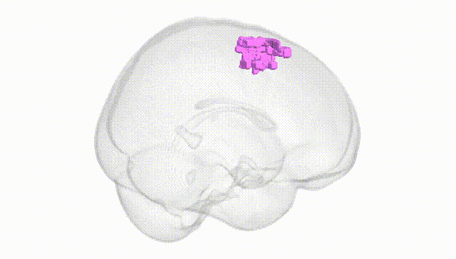 Full Brain White