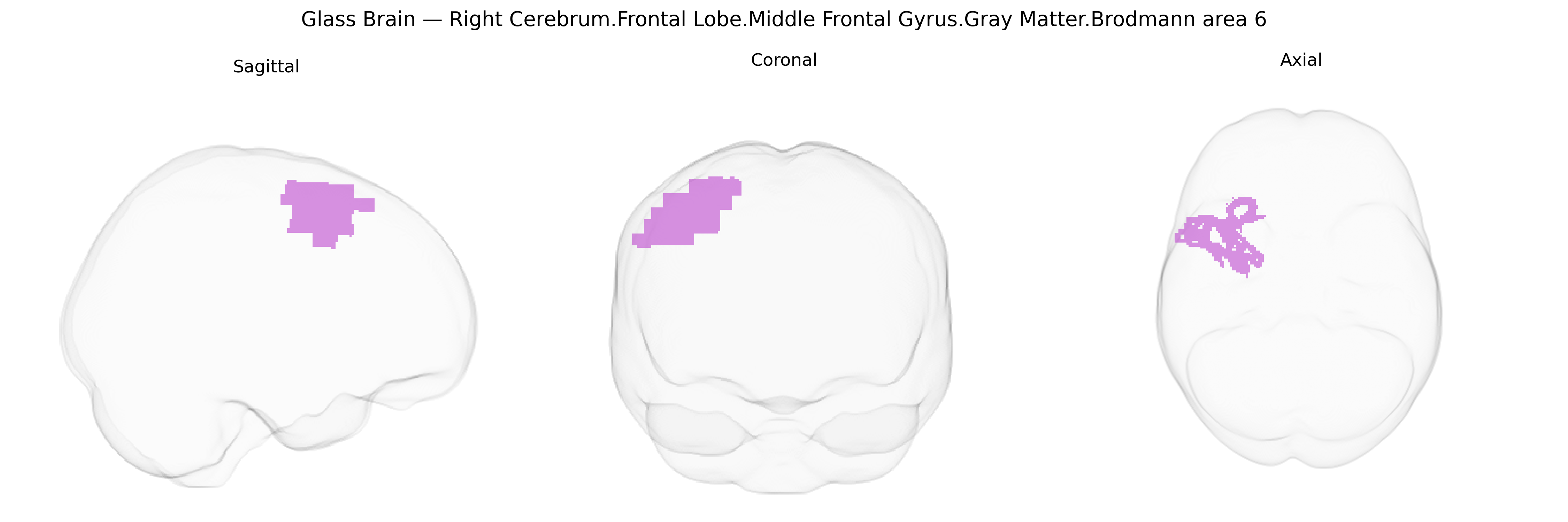 Triplanar Ghost Brain