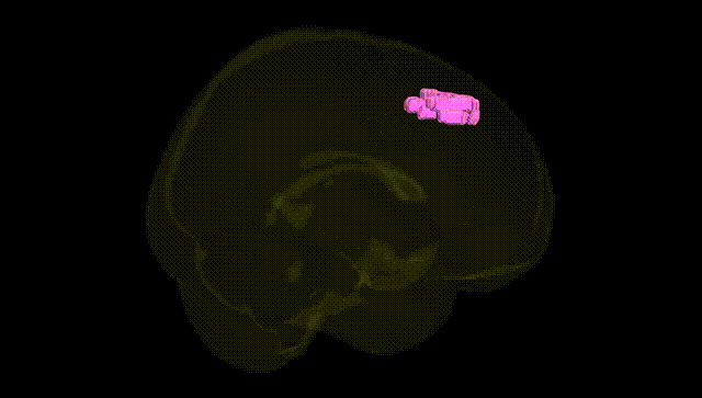 Full Brain Black