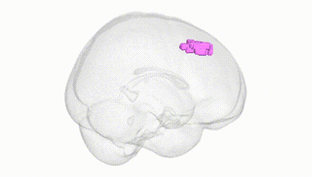 Full Brain White