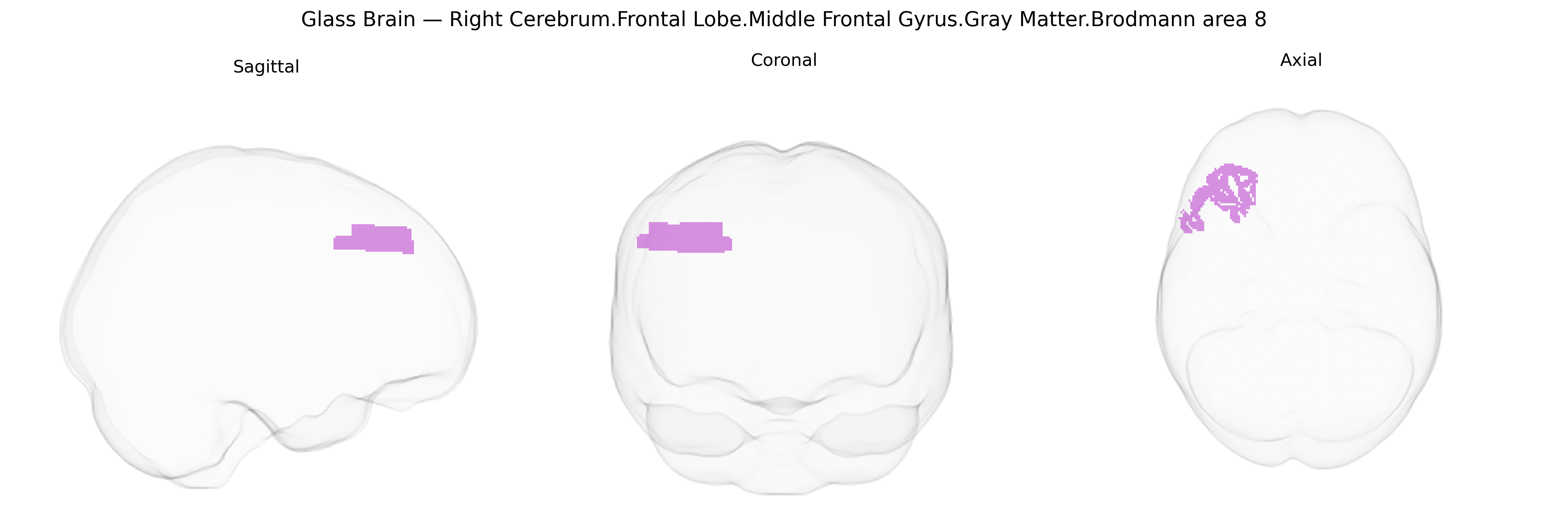 Triplanar Ghost Brain