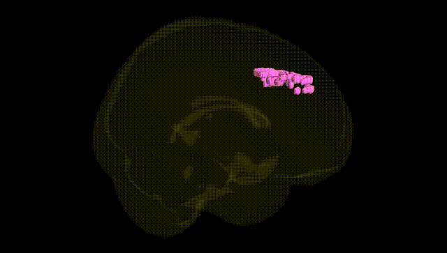 Full Brain Black