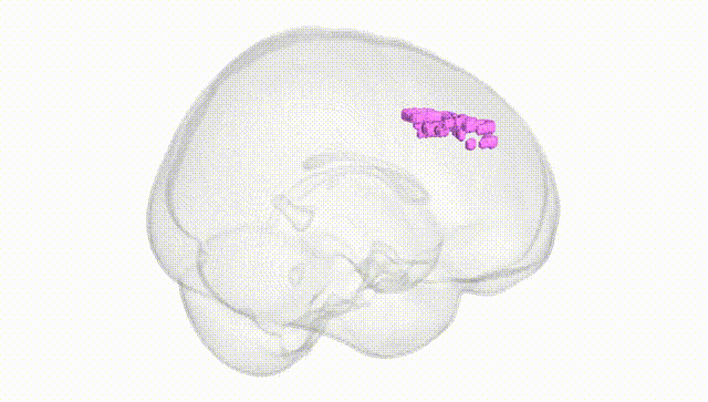 Full Brain White
