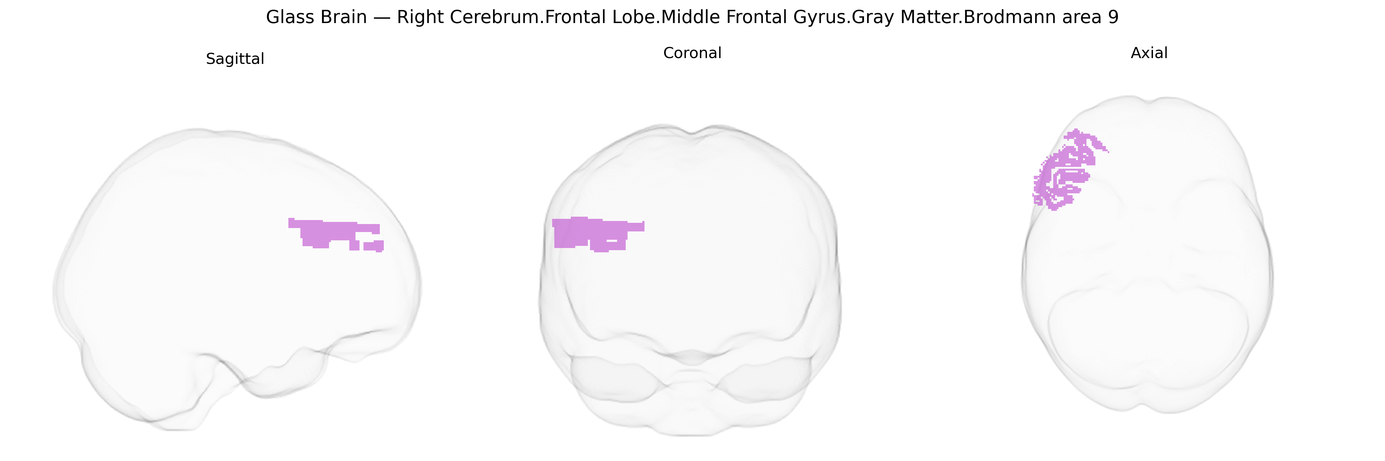 Triplanar Ghost Brain