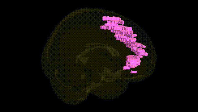 Full Brain Black