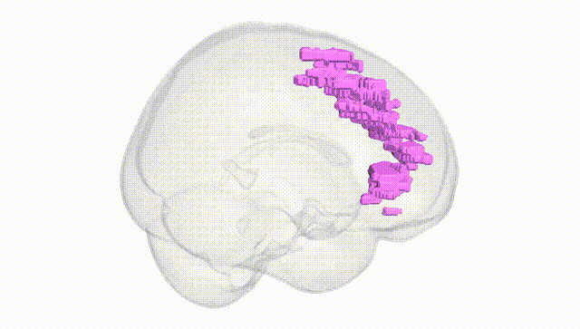 Full Brain White