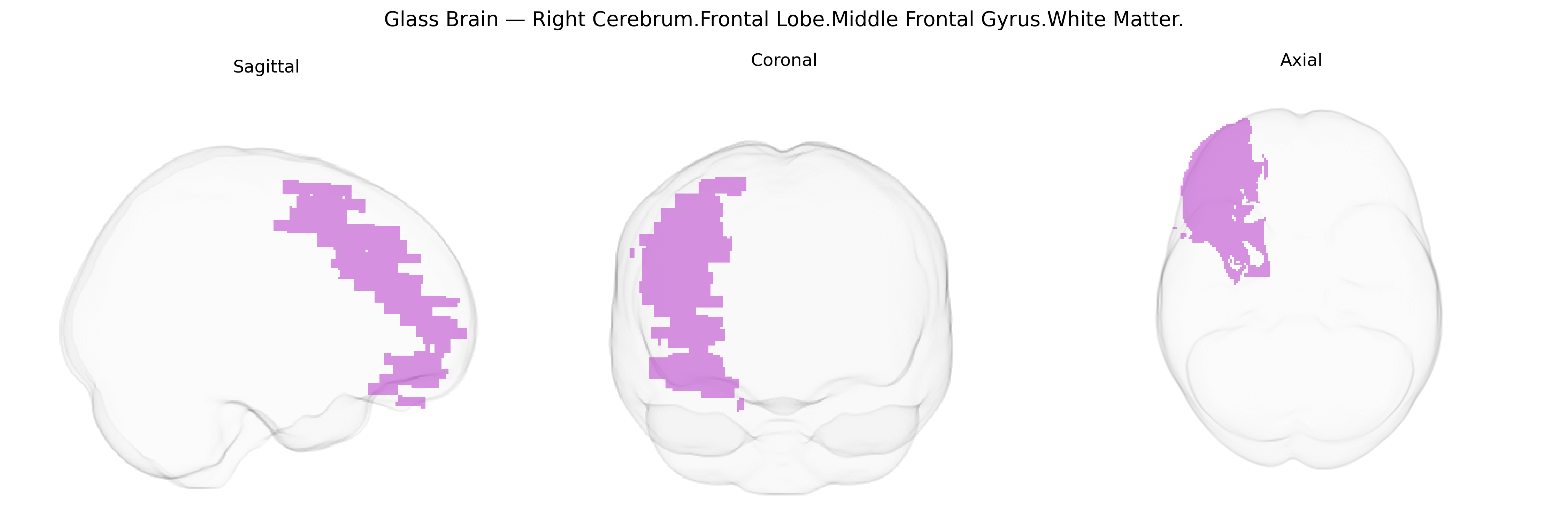 Triplanar Ghost Brain