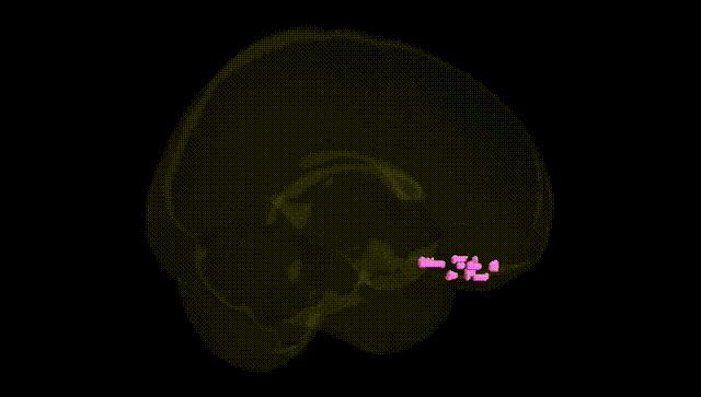 Full Brain Black