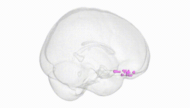 Full Brain White