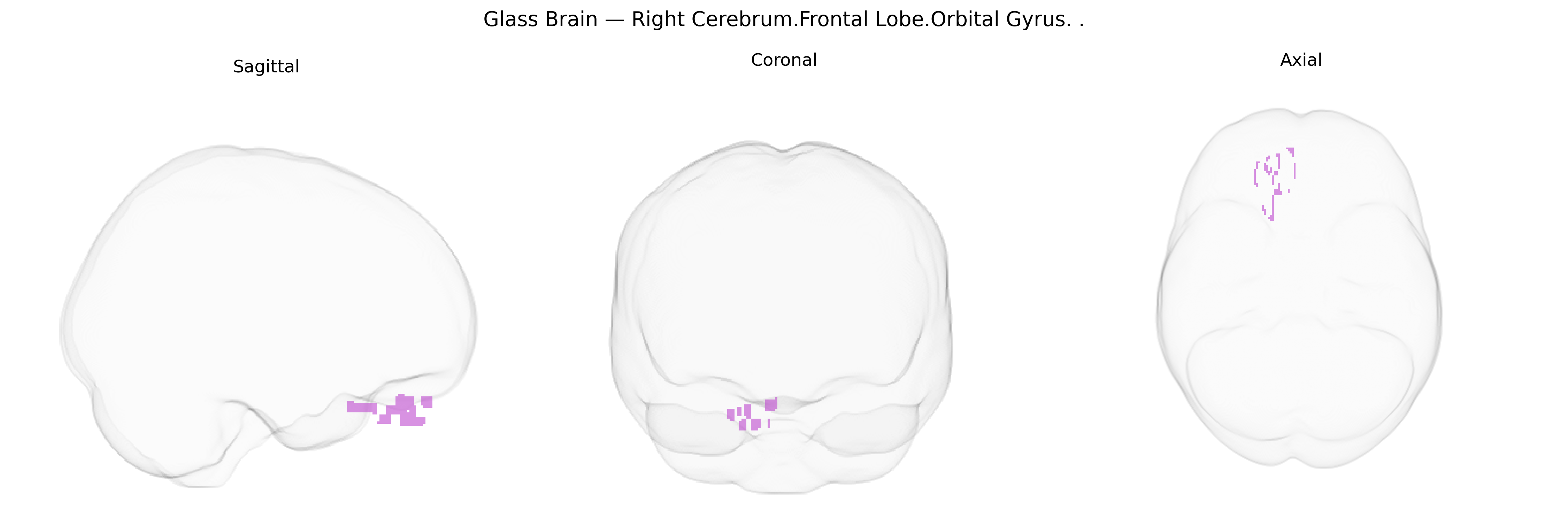 Triplanar Ghost Brain