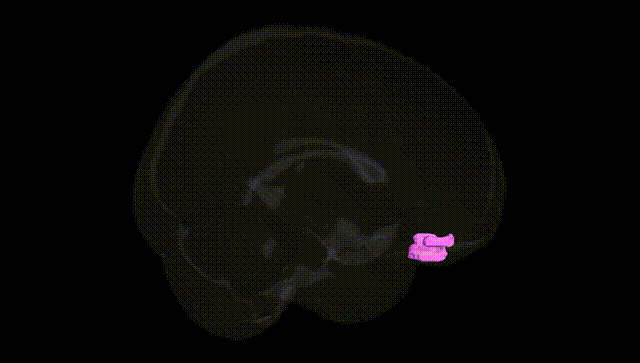 Full Brain Black