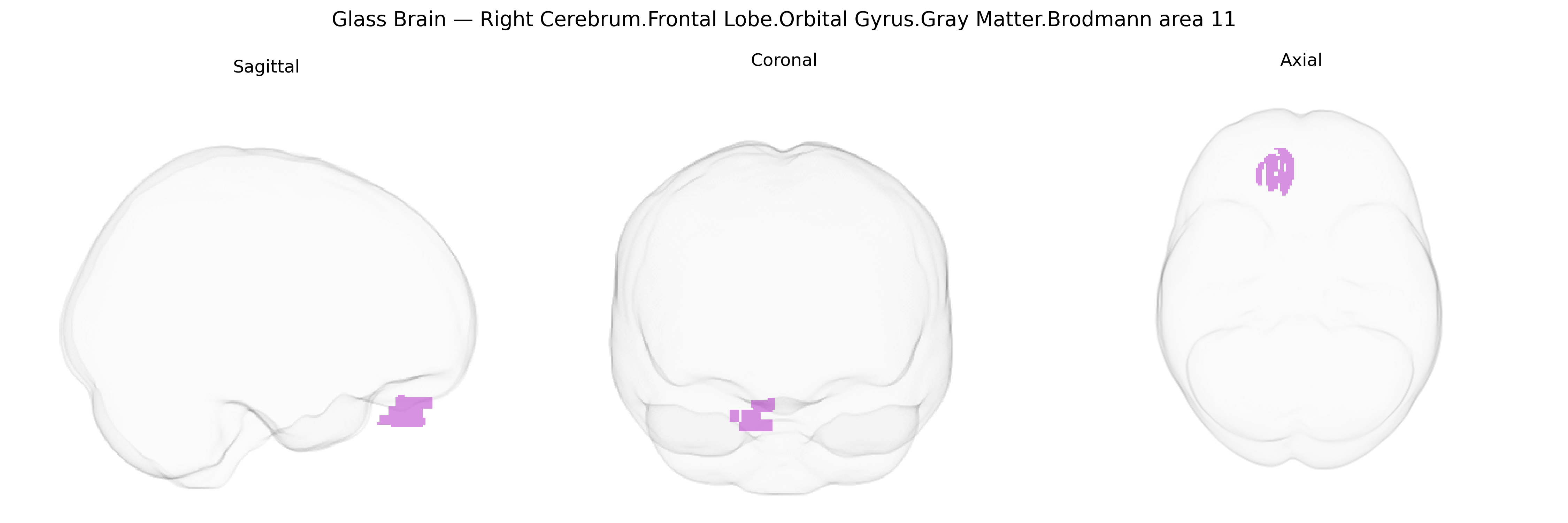 Triplanar Ghost Brain