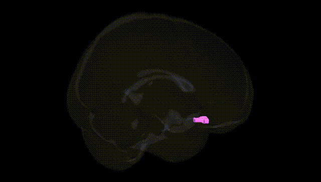 Full Brain Black