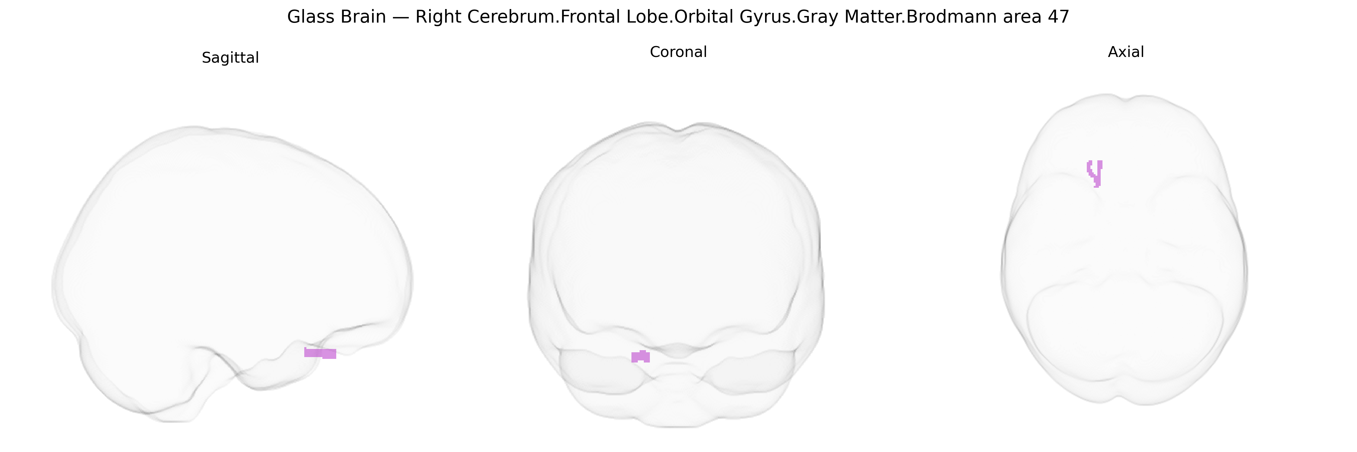 Triplanar Ghost Brain