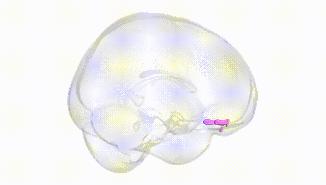 Full Brain White