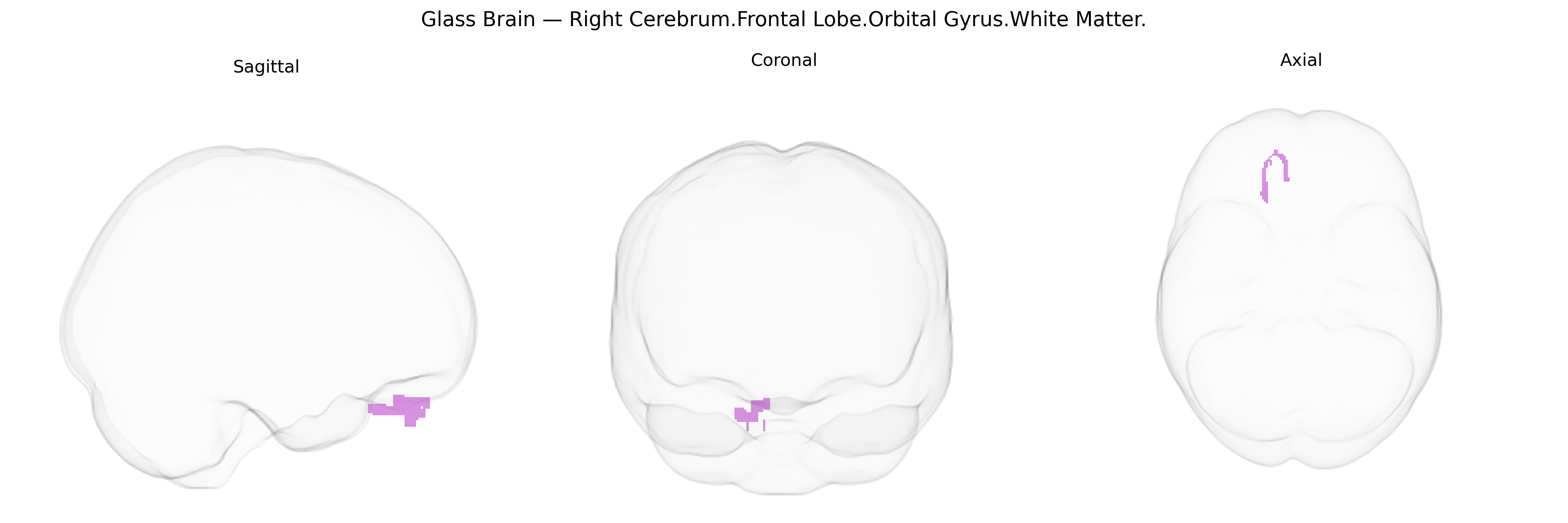 Triplanar Ghost Brain