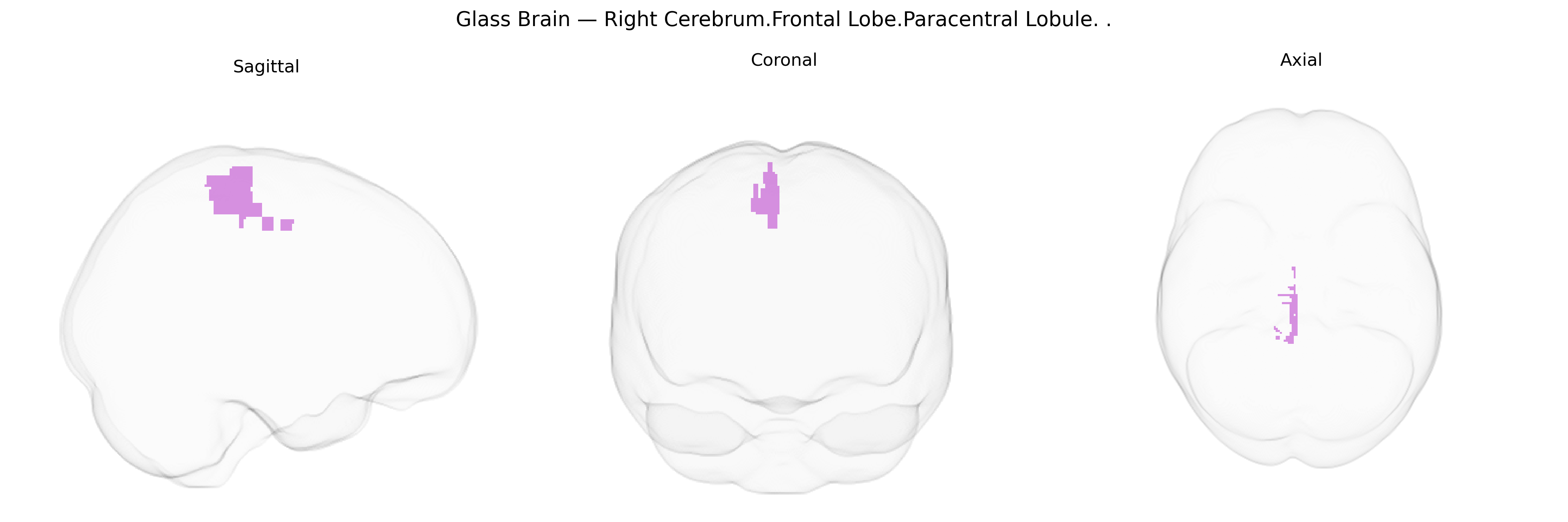 Triplanar Ghost Brain