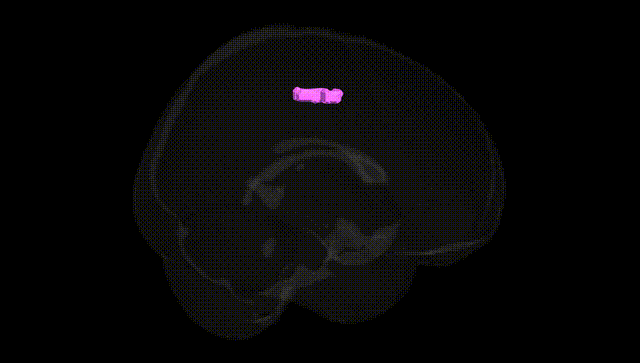Full Brain Black