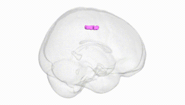 Full Brain White