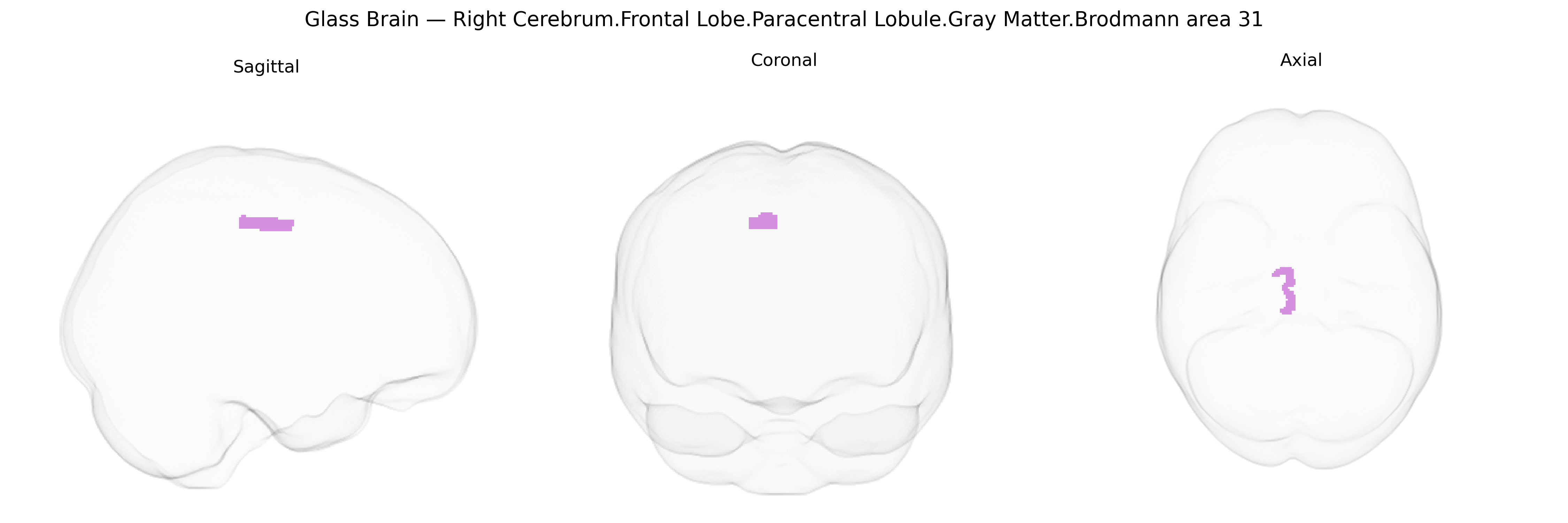 Triplanar Ghost Brain