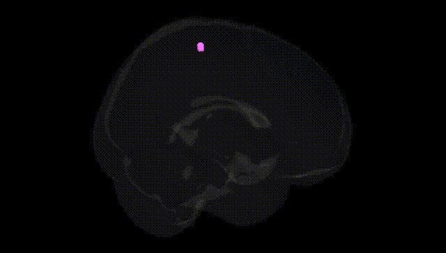 Full Brain Black