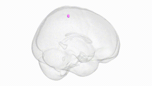 Full Brain White
