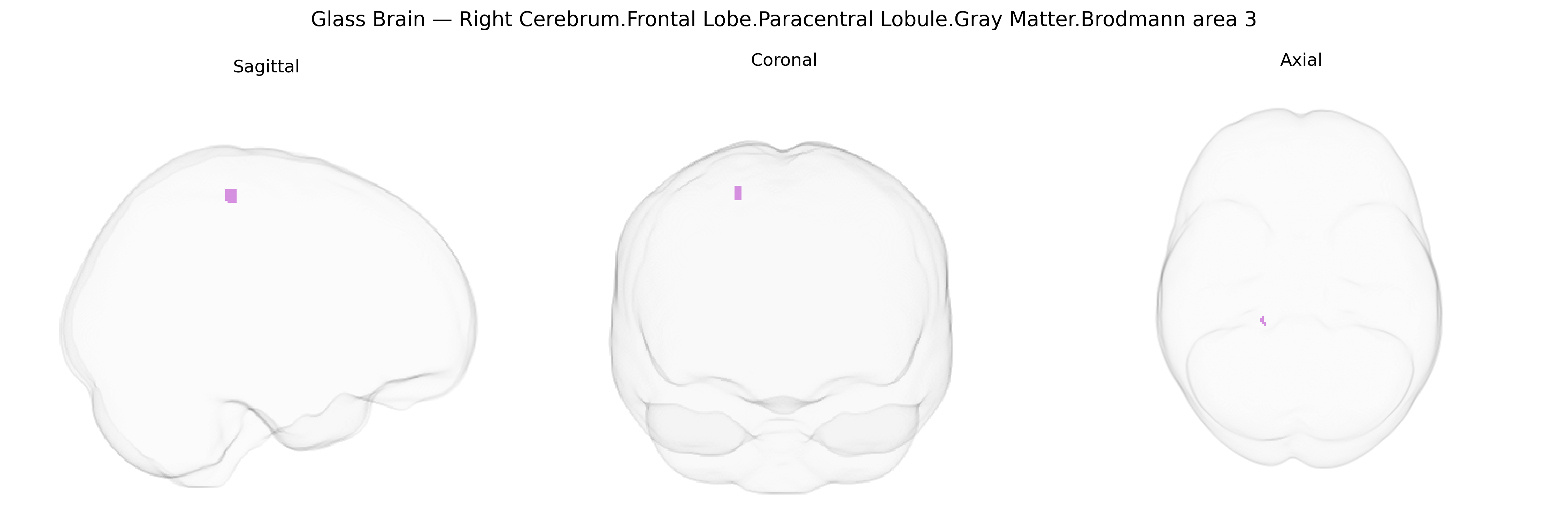 Triplanar Ghost Brain