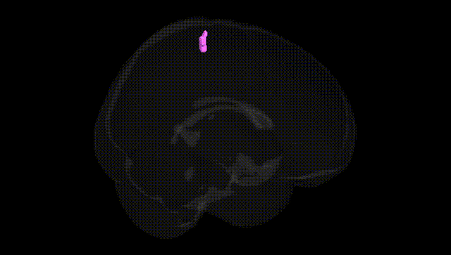 Full Brain Black