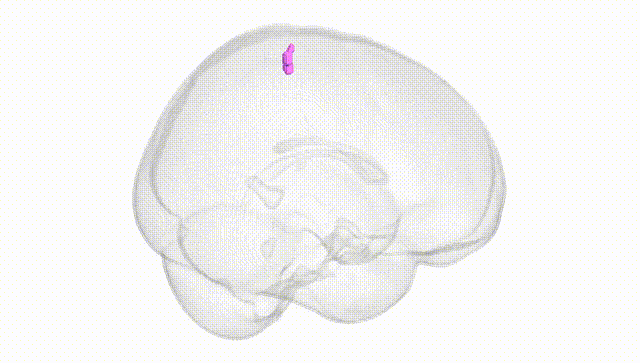 Full Brain White