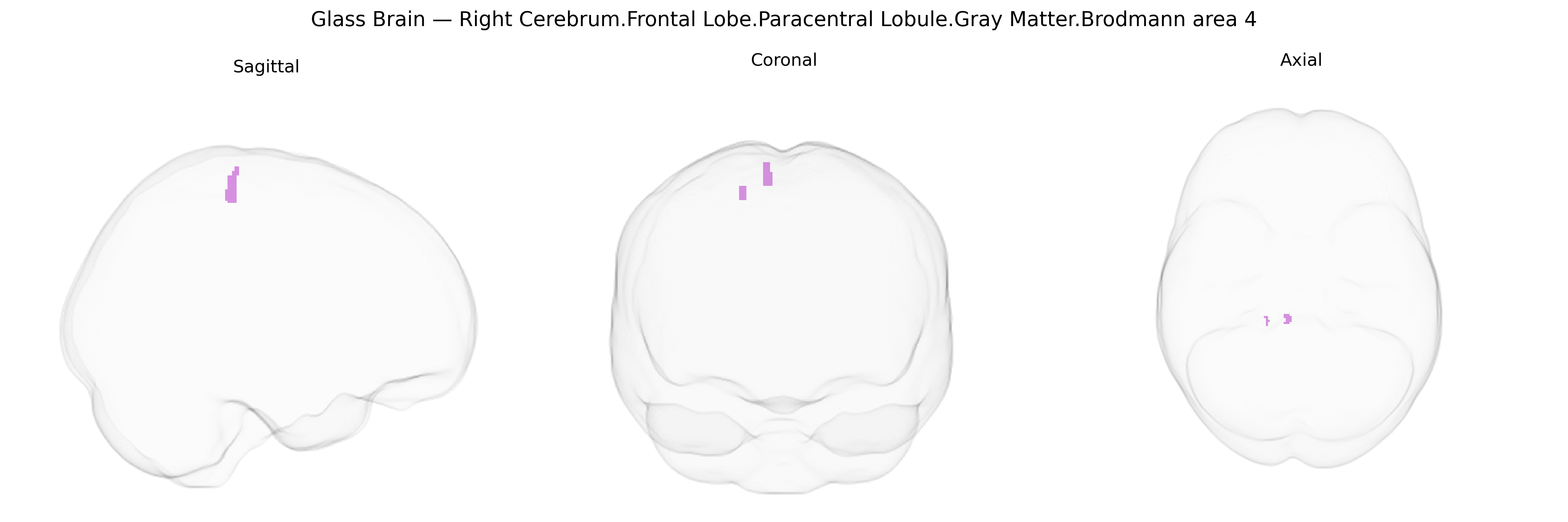 Triplanar Ghost Brain