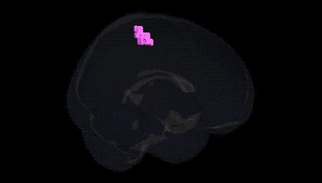 Full Brain Black