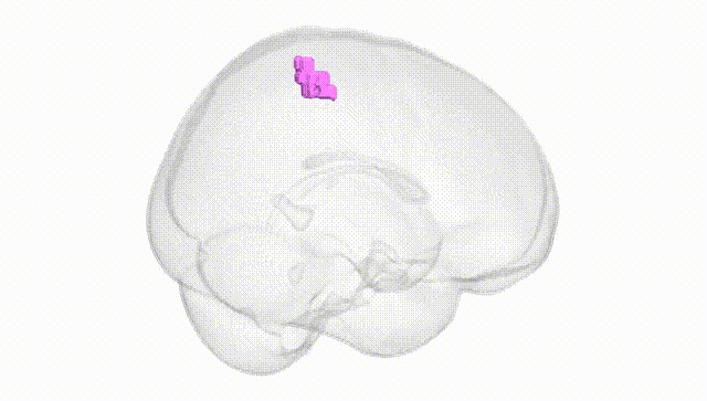 Full Brain White