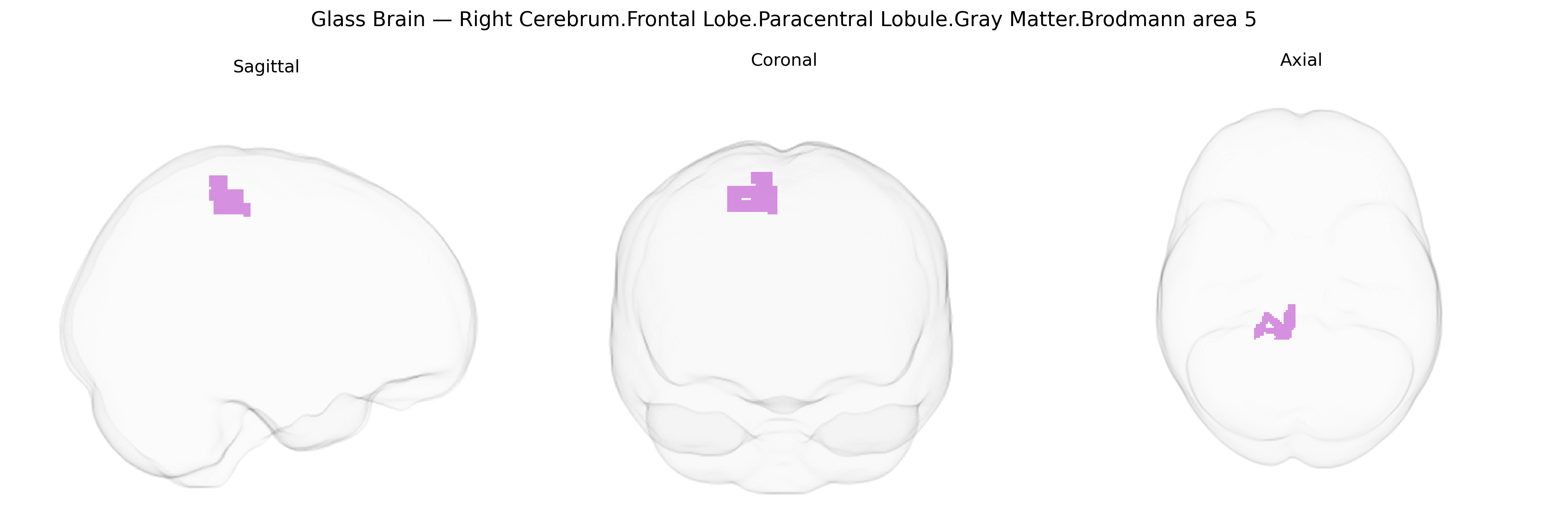 Triplanar Ghost Brain