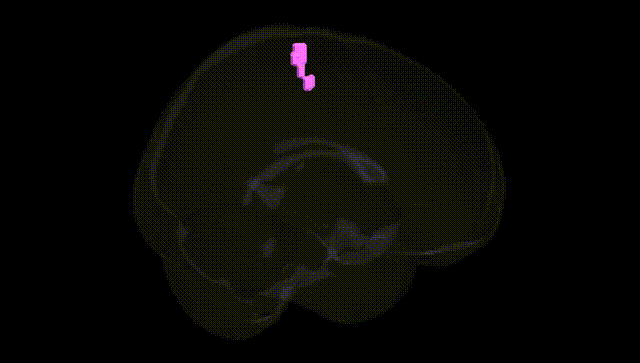 Full Brain Black