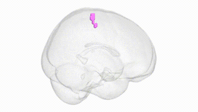 Full Brain White