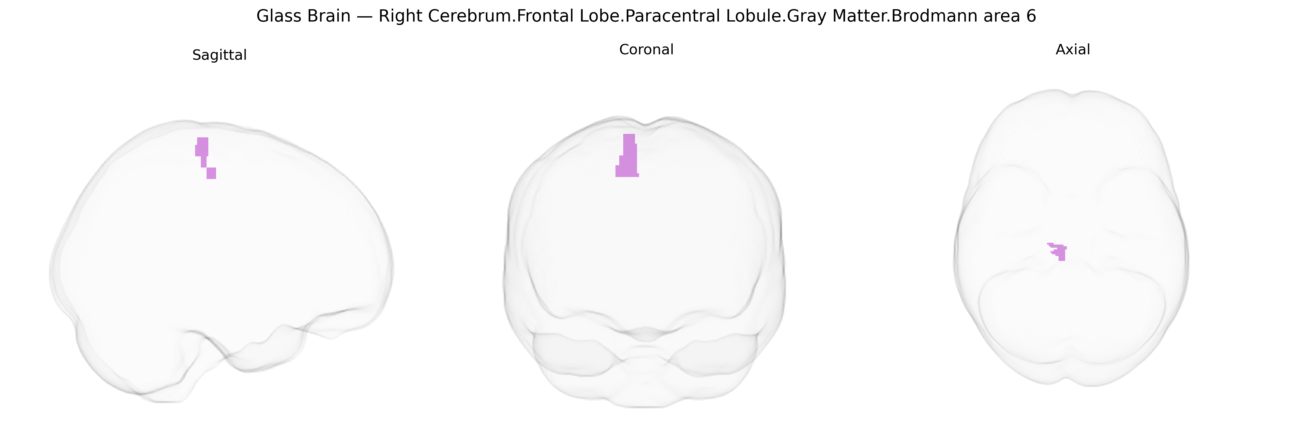 Triplanar Ghost Brain
