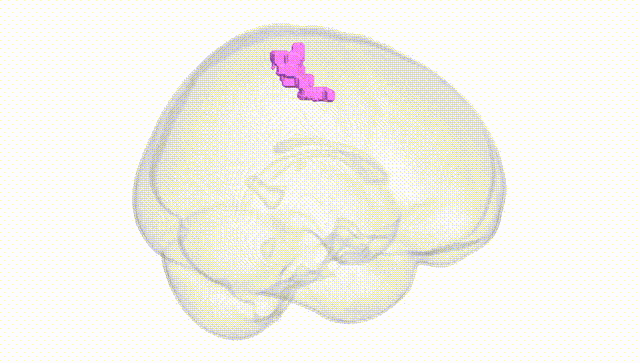 Full Brain White