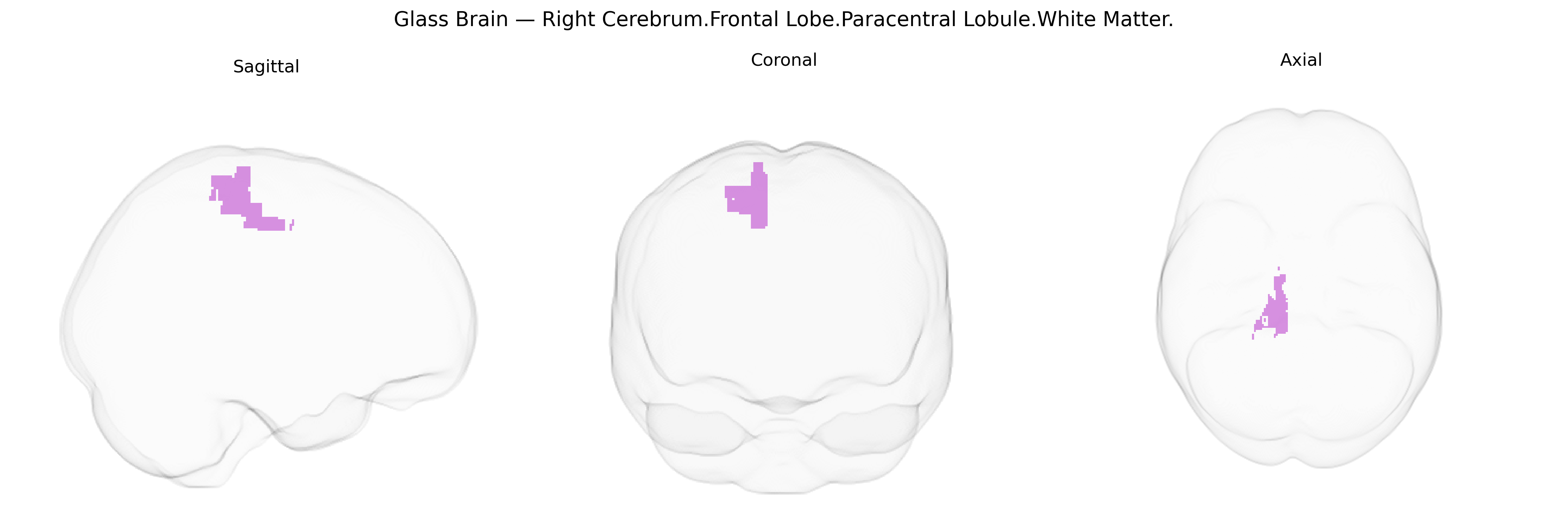 Triplanar Ghost Brain