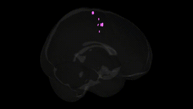 Full Brain Black