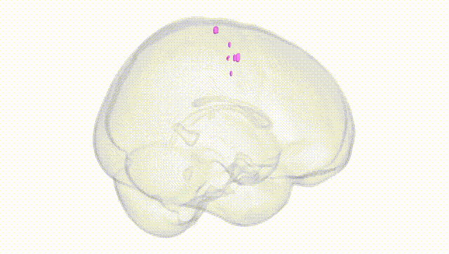 Full Brain White