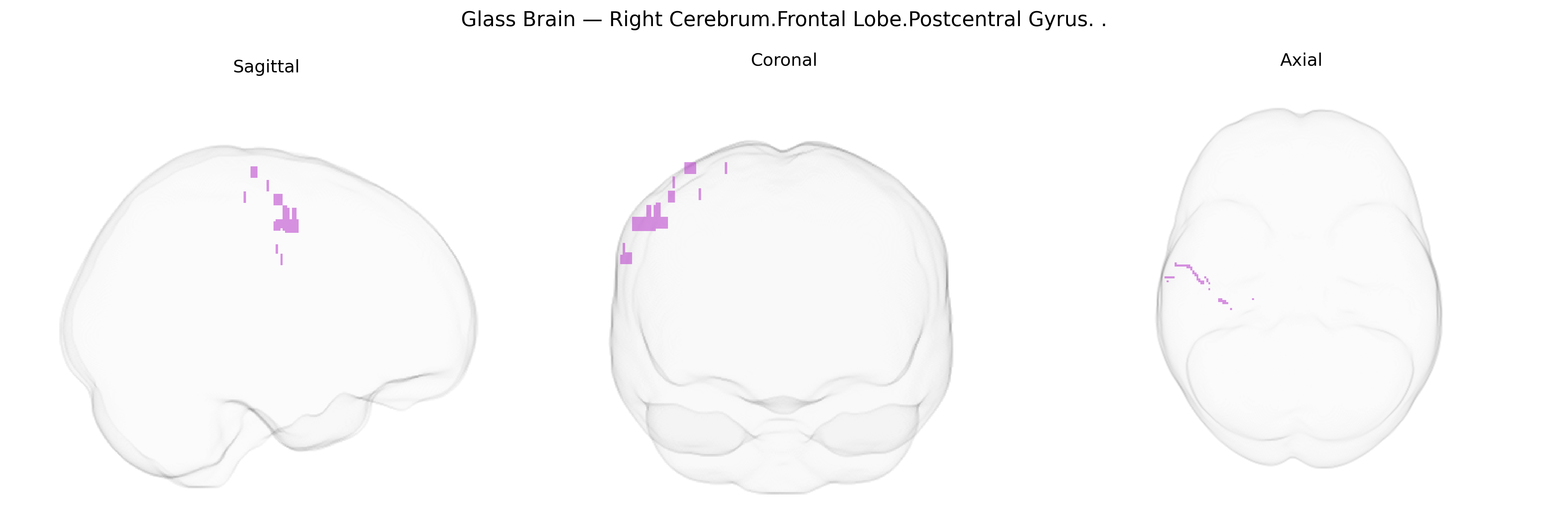 Triplanar Ghost Brain
